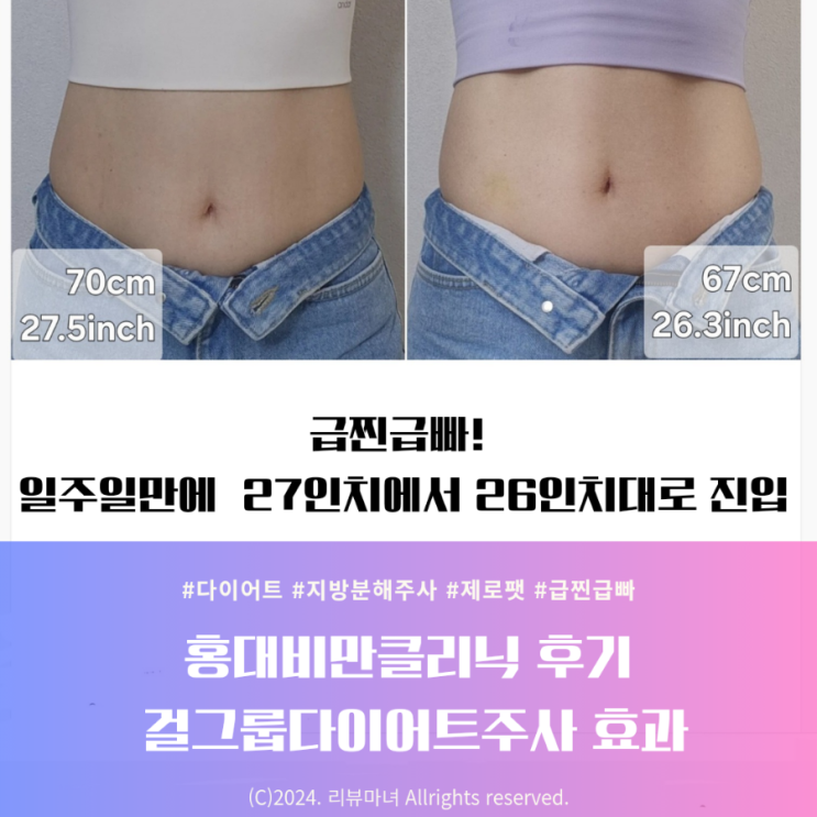  홍대비만클리닉 후기 걸그룹다이어트주사 효과_급찐급빠