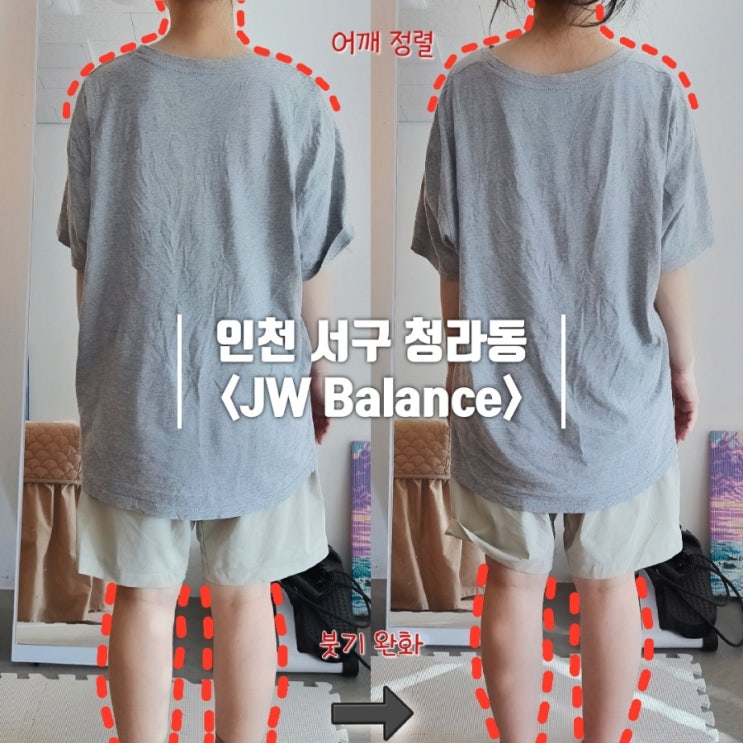  청라 마사지｜25년 경력 도수치료 전문박사가 운영하는 JW 체형밸런스