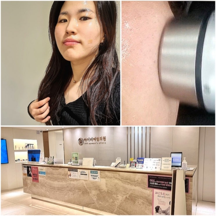  동대문역피부과 종로 산부인과 아이비여성의원 실력최고 내돈내산 솔직후기