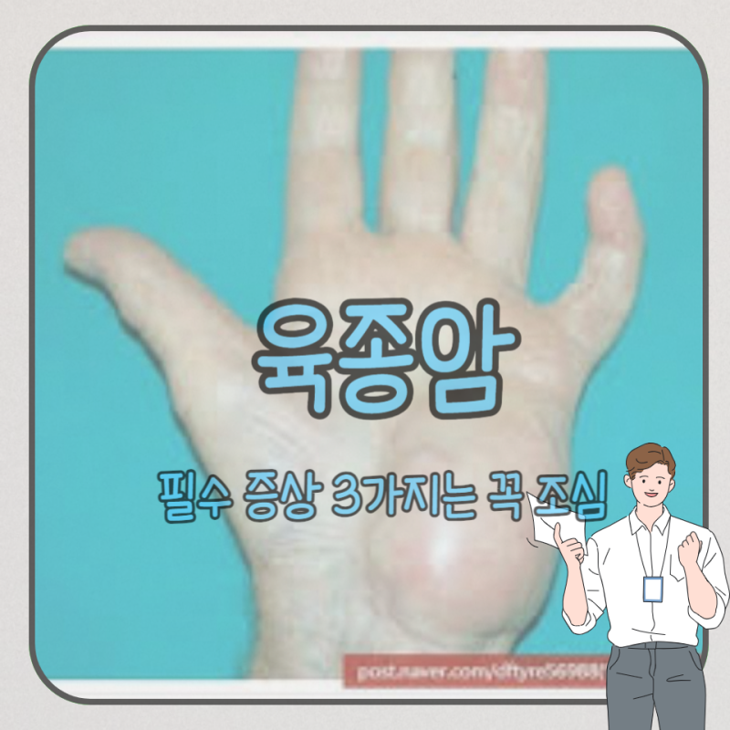 육종암 수술 완치 증상 3가지는?