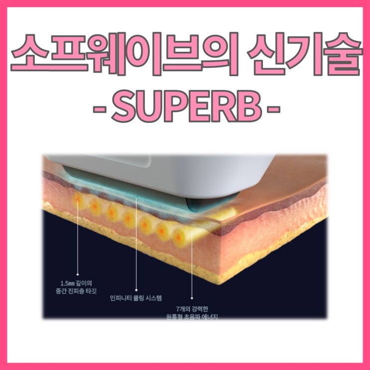  소프웨이브(Sofwave) 어떤 리프팅인가요?, SUPERB 기술에 관하여
