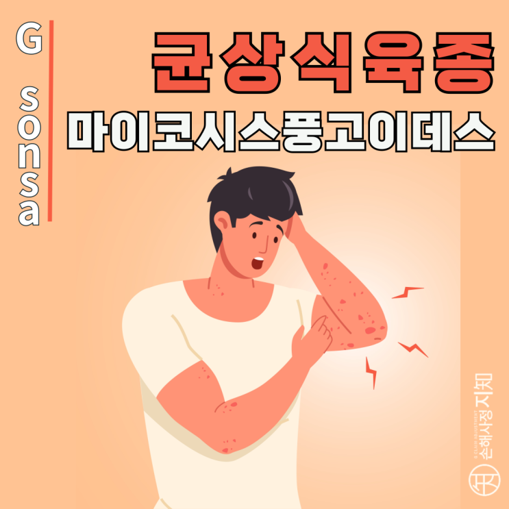 균상식육종(마이코시스풍고이데스), 피부에서 시작되는 희귀 림프종 - 〔아빠의 질병, 1부〕