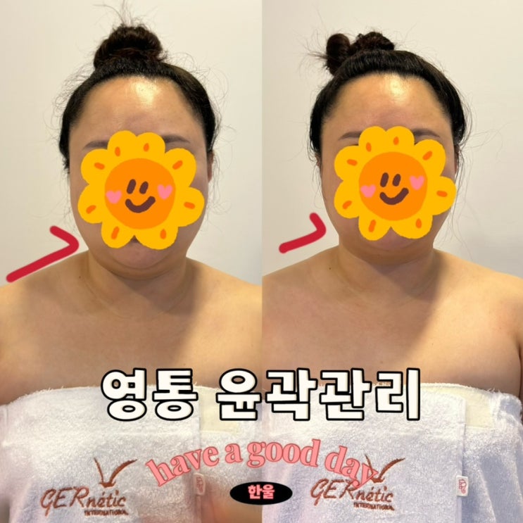  영통피부관리 아그니아 영통역 윤곽관리