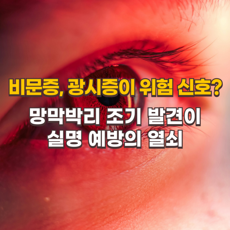  비문증, 광시증이 위험 신호? 망막박리 조기 발견이 실명 예방의 열쇠