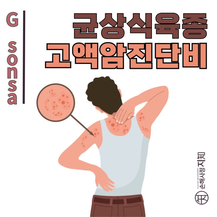  균상식육종 C84 고액암 진단비 보험금 제대로 받으셨나요? - 〔아빠의 질병, 2부〕
