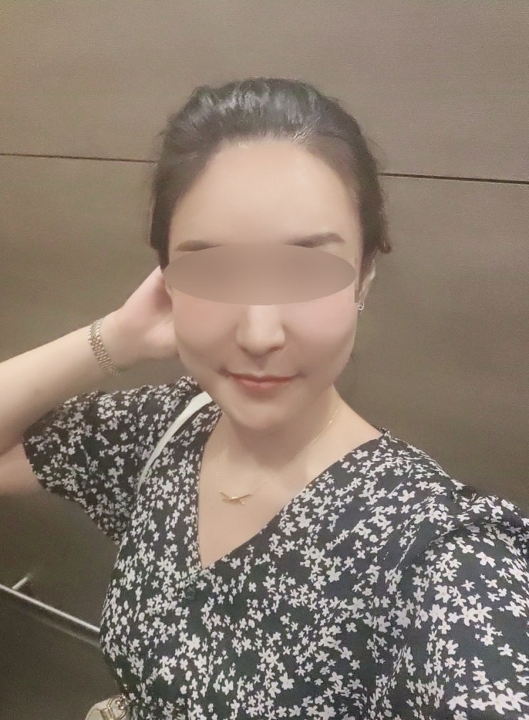  환절기 피부 관리 방법 : 신사역성형외과 쥬베룩 스킨부스터  1~4주 효과 본 후기 + 부작용, 통증 / 인젝터, 손주사 X
