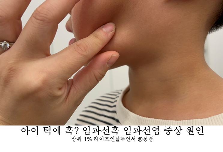 아이 귀뒤에 목뒤에 턱에 혹 림프절 임파선혹 임파선염 림프절염 원인 증상 치료 아이 귀뒤에 목뒤에 턱에 혹 림프절 임파선혹 임파선염 림프절염 원인 증상 치료