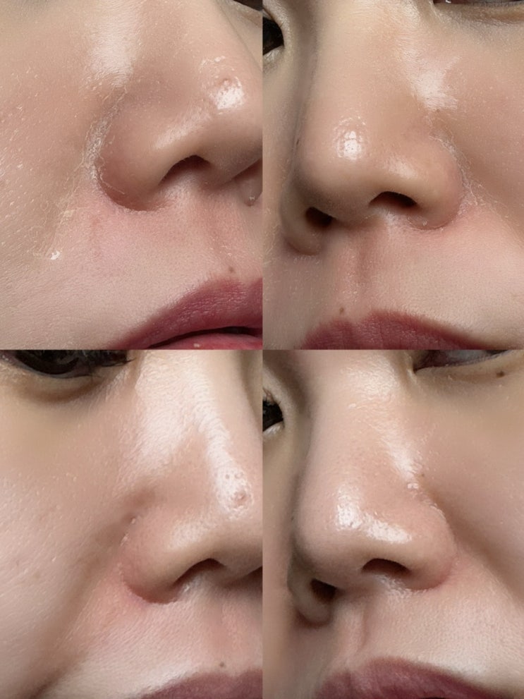 피부과화장품 더미스랩 리쥬버네이트 포텐셜 크림 + 더미스랩 딥 클리어 엔자임 파우더 꿀조합 인정