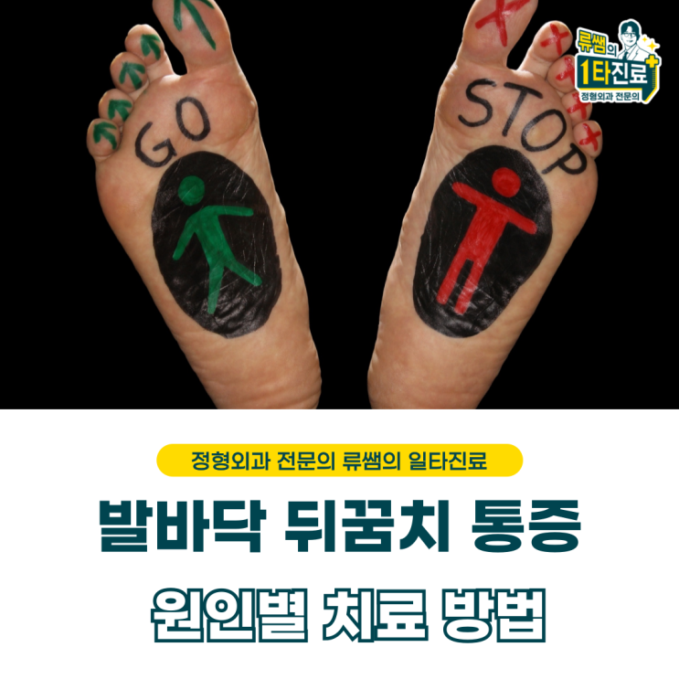  발바닥 뒤꿈치 통증 원인별 치료 방법 (의사 작성)