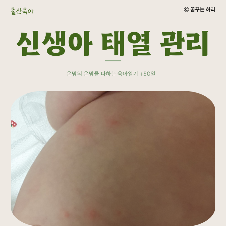  온맘의 육아일기 D+50일 8주차 신생아태열 태열원인 태열증상 태열관리방법