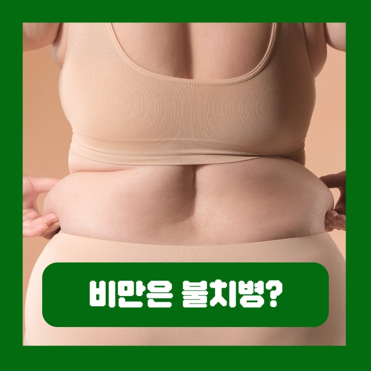  비만은 불치병? 우리 다이어트가 실패하는 이유