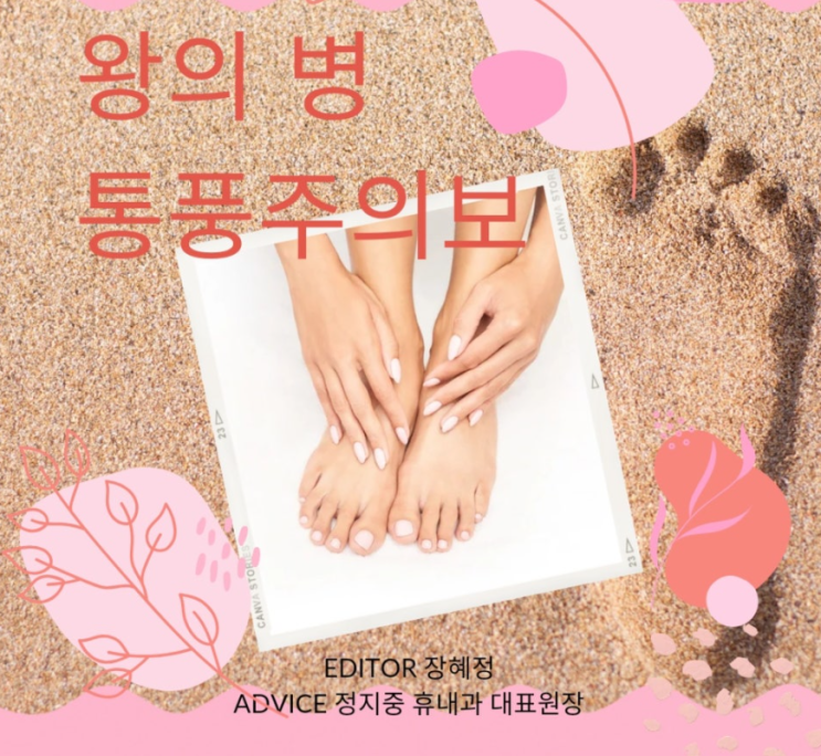  왕의병 "통풍" 주의보