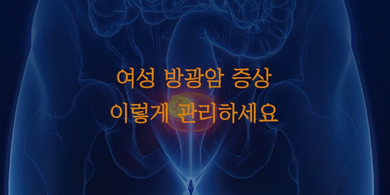 여성 방광암 증상 원인과 관리방법은?