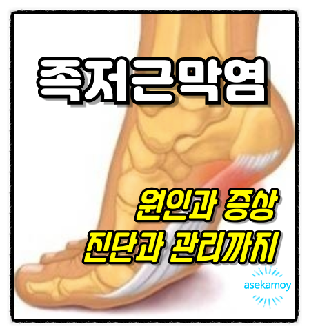 족저근막염의 진단과 관리법 정리
