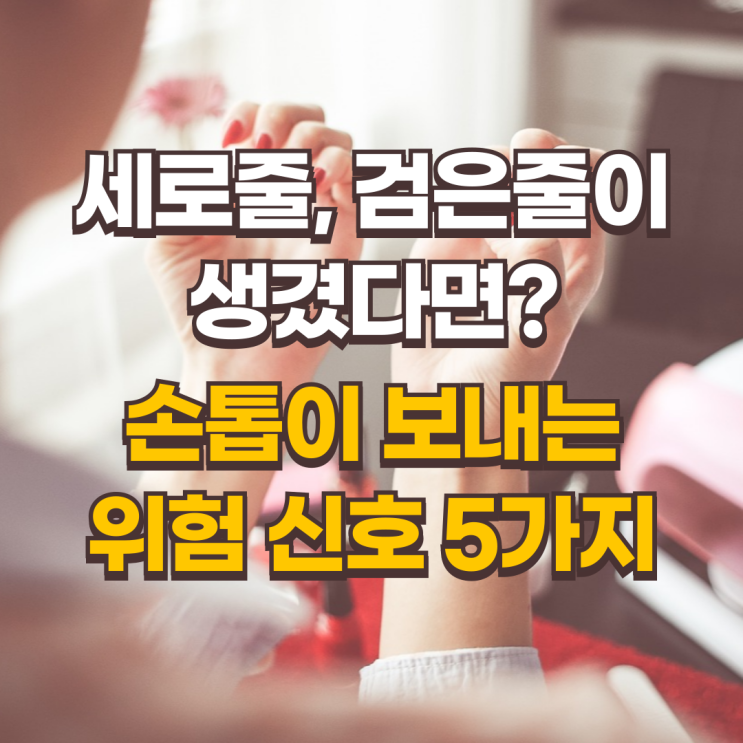  손톱에 세로줄, 검은줄이 생겼다면? 울퉁불퉁 손톱이 보내는 위험 신호 5가지