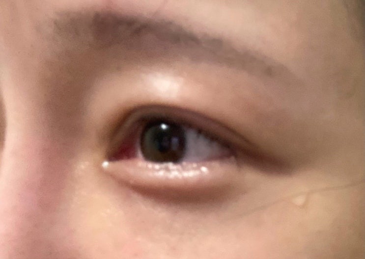  [호주:브리즈번] 떠먹여줘도 못먹는 트라이얼과 인터뷰의 연속