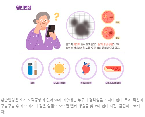 “직선이 구불구불? 시야에 암점이 생겼다면, 황반변성 의심해야 할 때!” ️ “직선이 구불구불? 시야에 암점이 생겼다면, 황반변성 의심해야 할 때!” ️