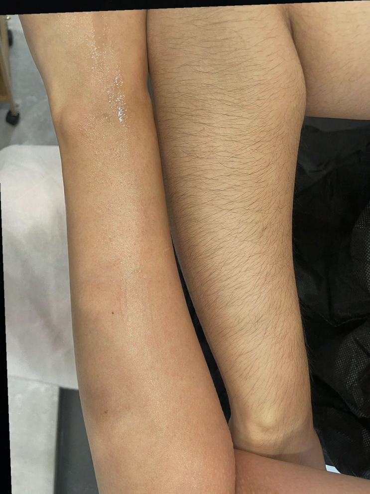  예쁨왁싱 수원인계점, 빠르고 정확한 브라질리언 왁싱의 매력