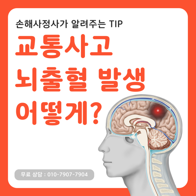  교통사고 뇌출혈 합의금 얼마 받아야 할까? 현직자가 알려줍니다