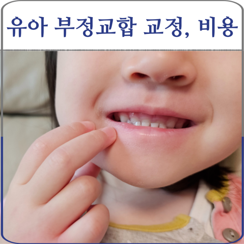 유아 부정교합 교정 치료 시기, 비용