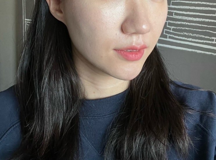  티타늄레이저 + 튠라이너로 턱선리프팅 후기