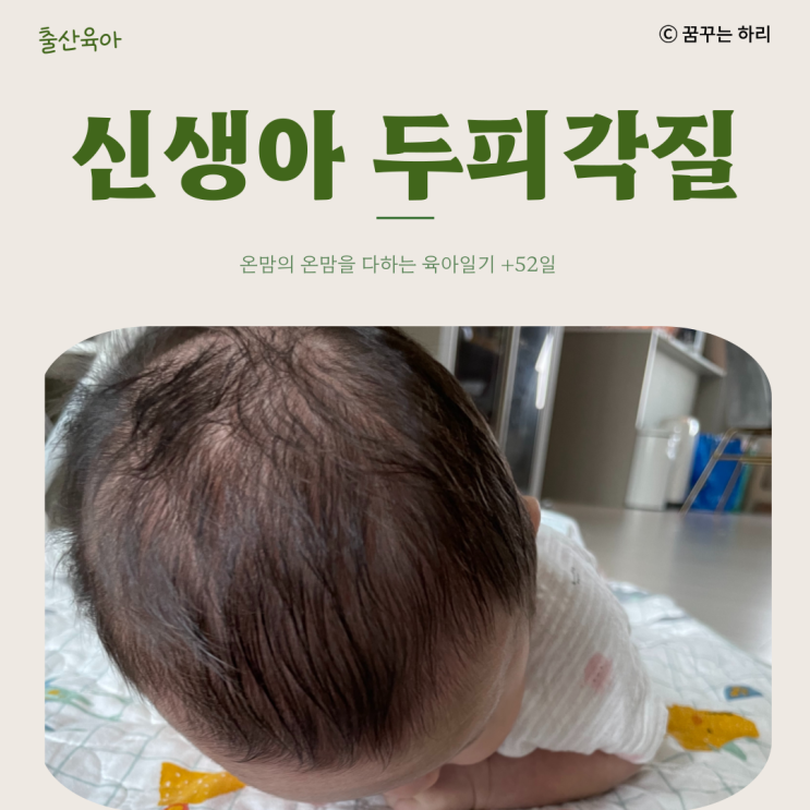  온맘의 육아일기 D+52일 8주차 수유텀 수면시간 신생아두피각질 노란딱지 두피각질원인 두피각질관리법