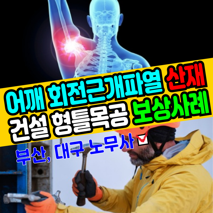  [부산, 대구 노무사] 건설 형틀목공 목수 어깨 회전근개파열 산재 보상사례