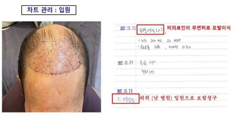 보험사기 위해 병원 설립한 부산 전문의... 보험금 64억 '꿀꺽' 보험사기 위해 병원 설립한 부산 전문의... 보험금 64억 '꿀꺽'