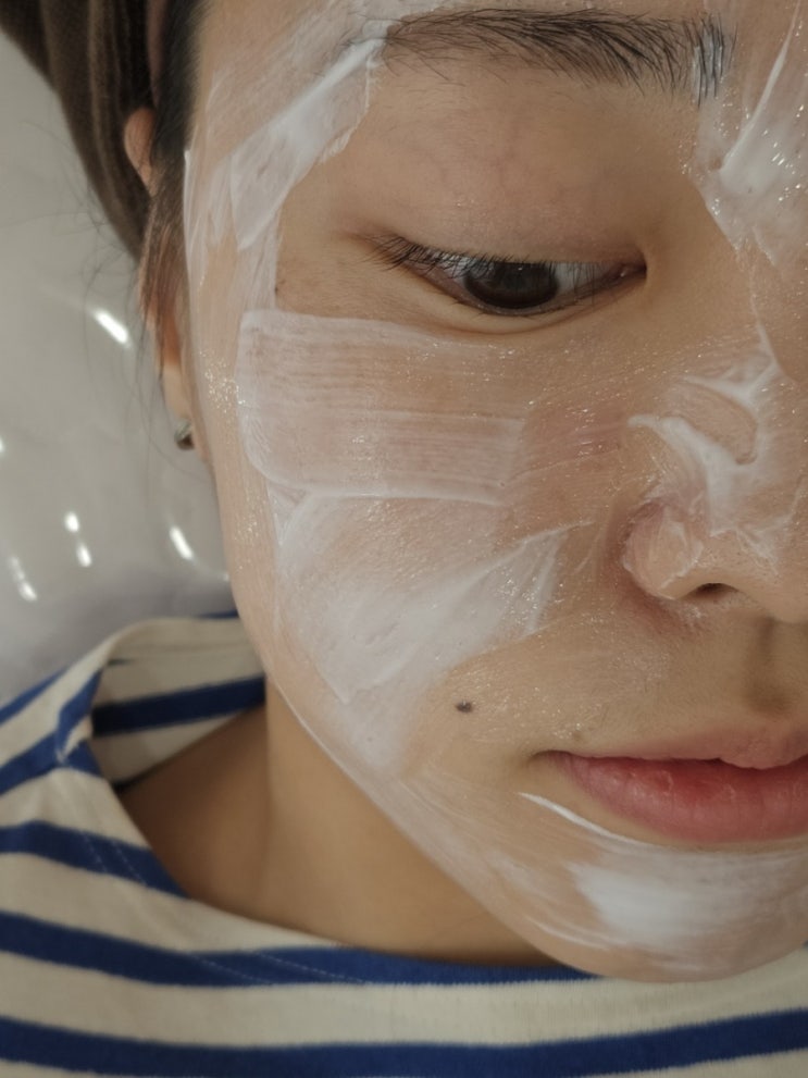  천안 피부관리 추천 미작뷰티 천안점 토닝 및 잡티 제거 후기! 두정동잔흔제거