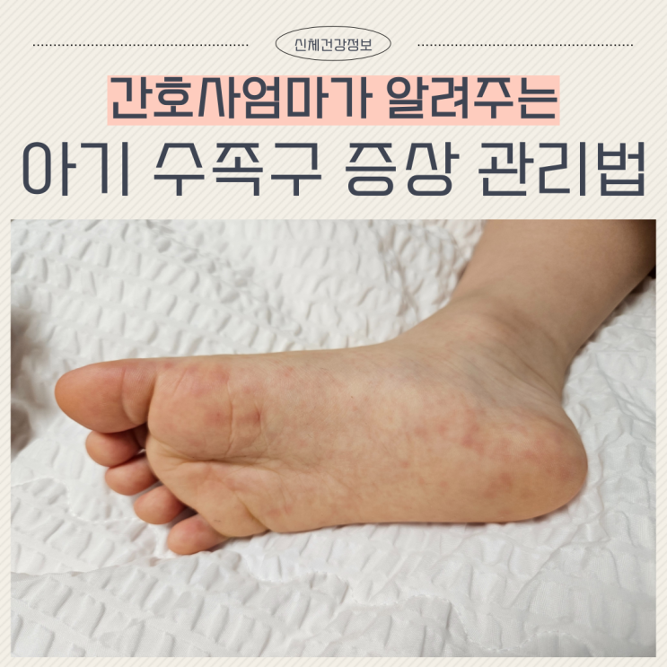  아기 수족구 증상 치료 관리 방법