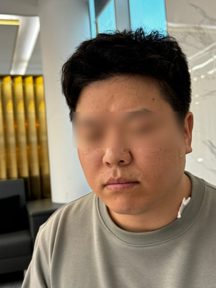  광주 남성레이저 인중 턱끝 수염 제모