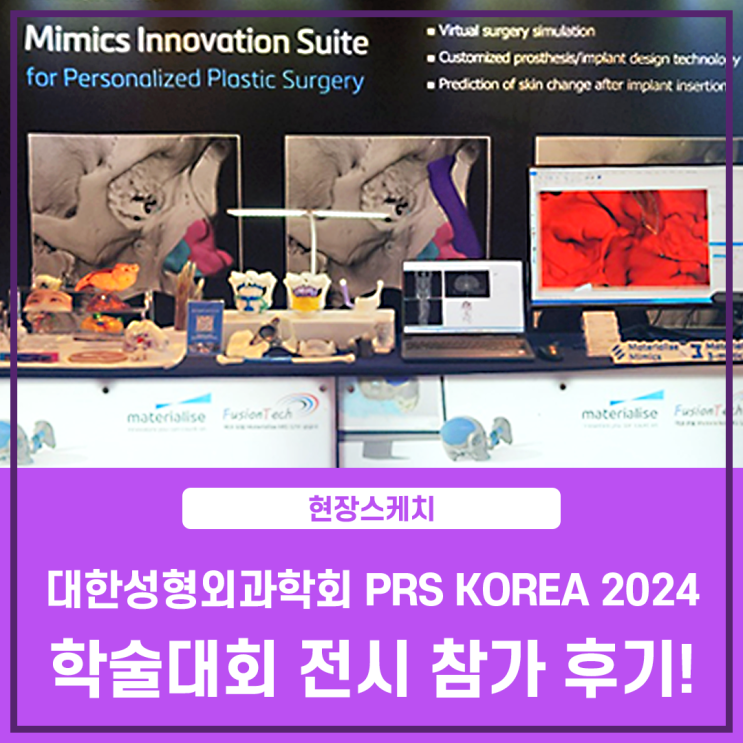  [현장스케치] 퓨전테크놀로지, 대한성형외과학회 PRS KOREA 2024 전시 후기!