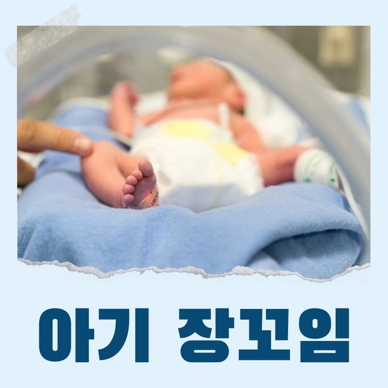 아기 장꼬임 증상 수술 설사 미리 알아두셔야 합니다