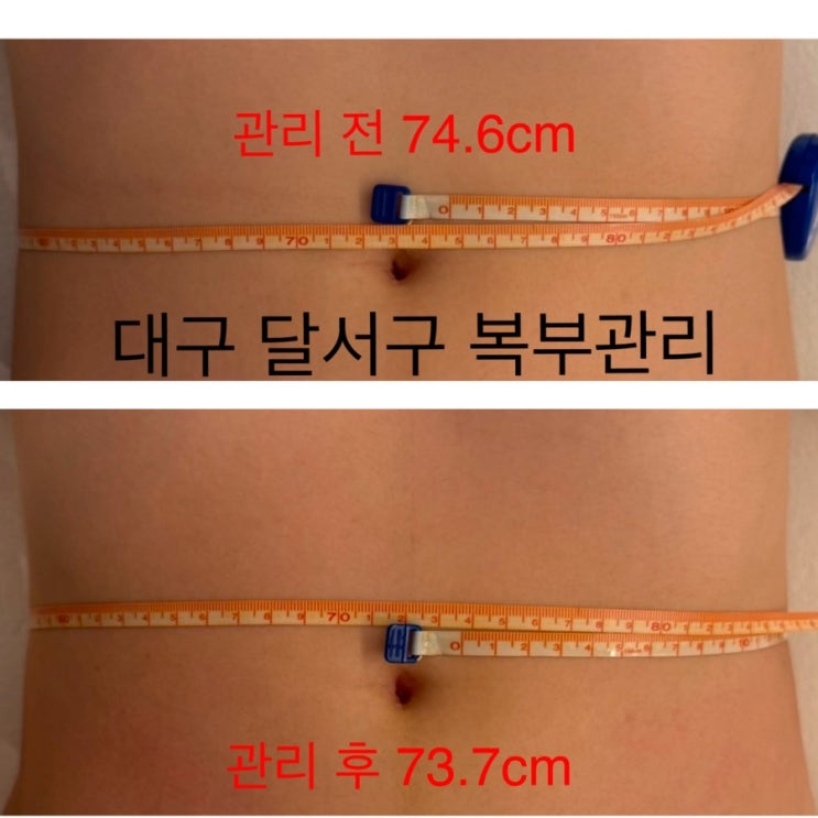  대구 달서구 복부관리 월성동 웨딩관리 하울뷰티