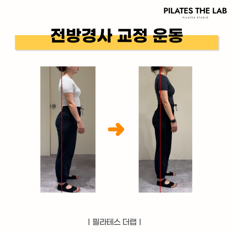  목동 필라테스 전방경사 교정 운동 후기
