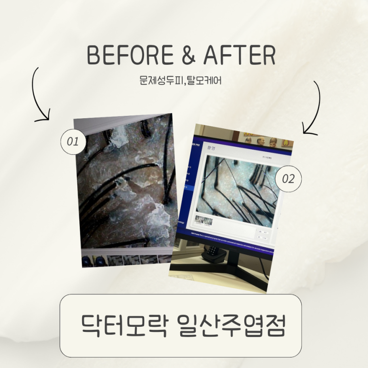  일산주엽두피관리 닥터모락 일산주엽점