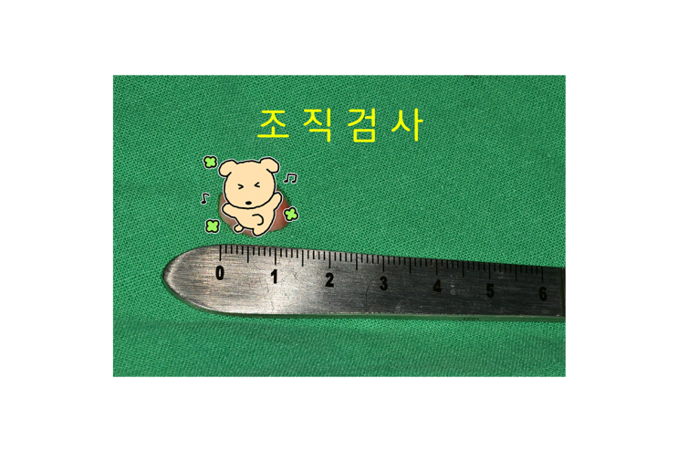  금광동 조직 검사 치과 구강 내에 있는 이상 부위 조직 검사 한 케이스