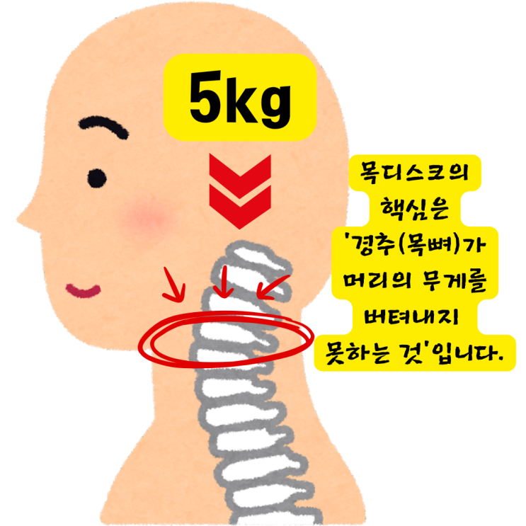  장산역한의원, 목디스크 통원치료로 수술 없이, 재발 없이 회복하는 방법