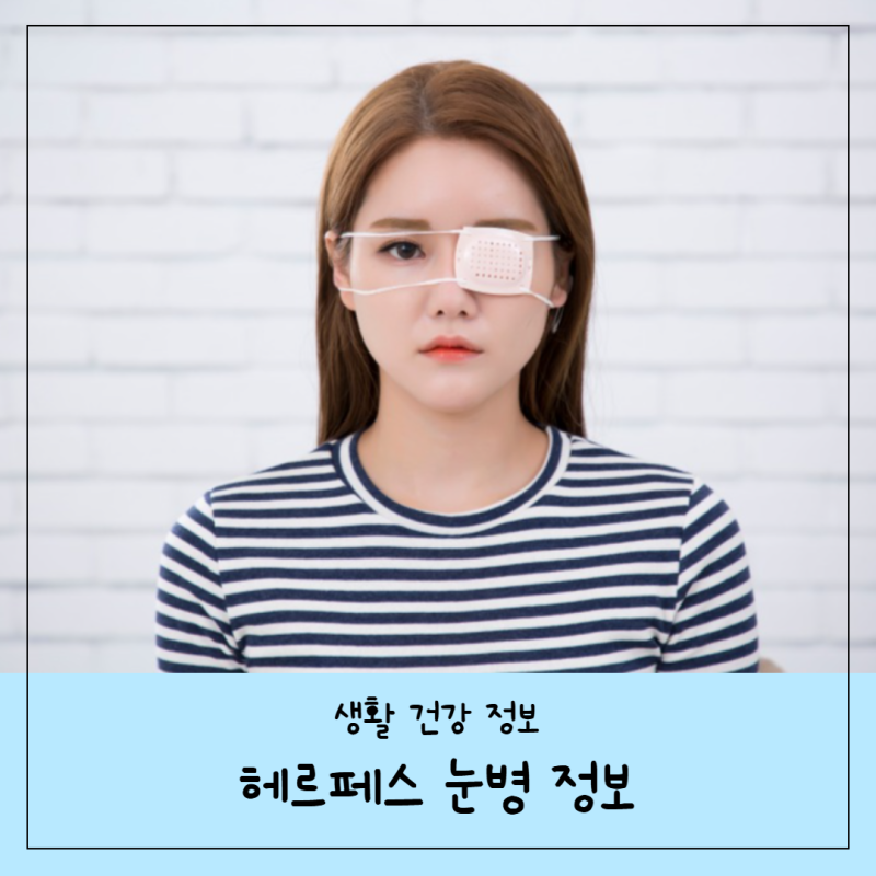 헤르페스 눈병 원인 증상 치료 정보