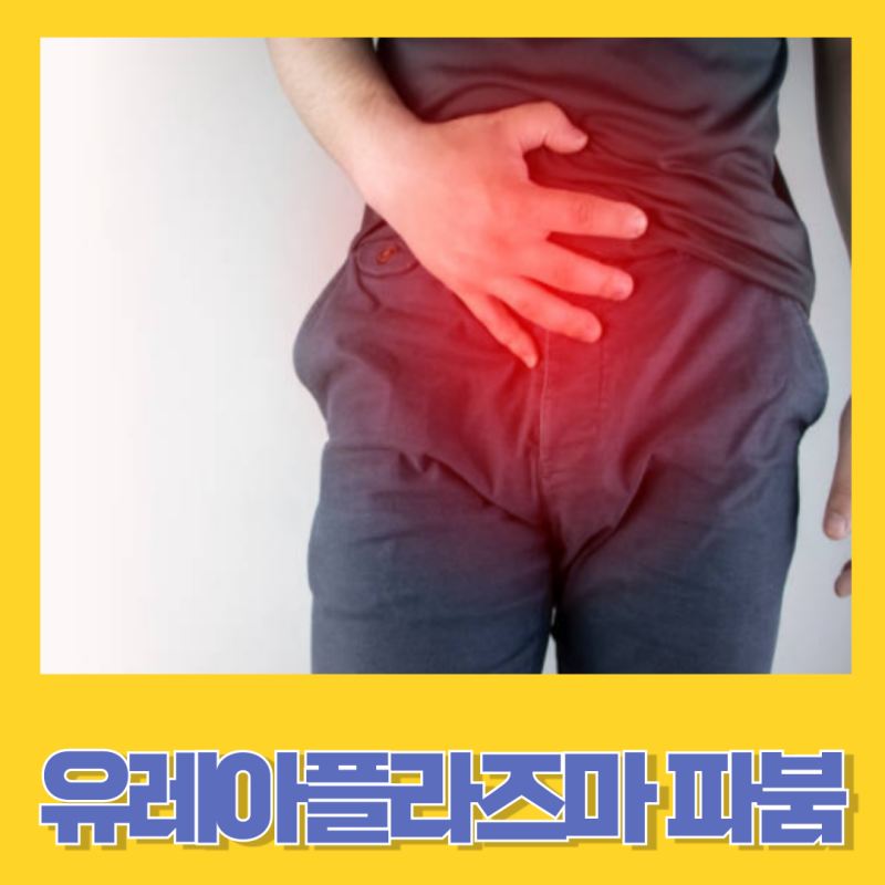 유레아플라즈마 바붐 알아야 할 감염증상과 치료 방법