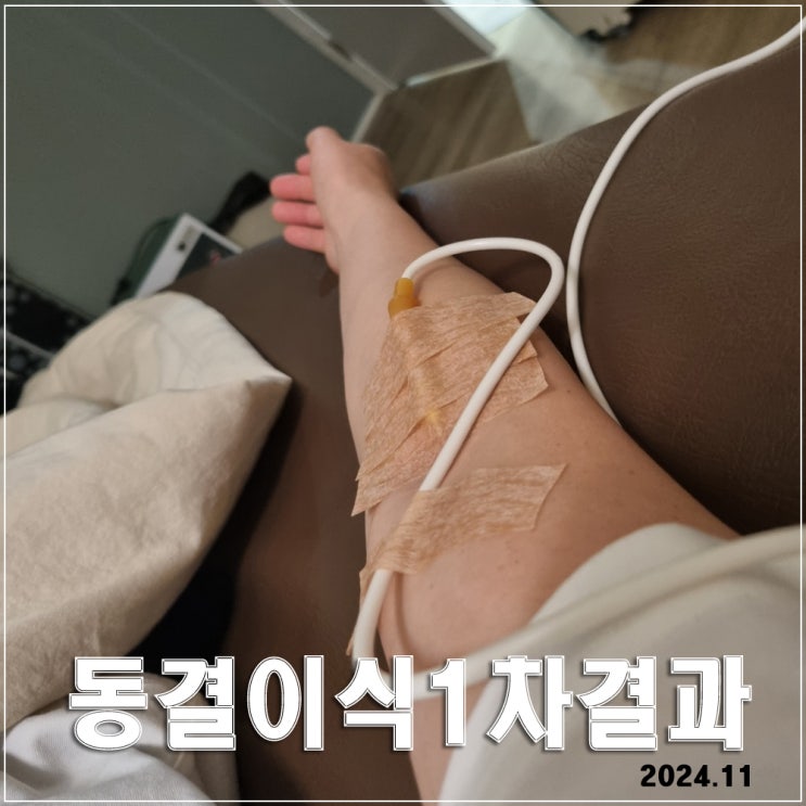  동결 이식 1차 결과 : 9일간의 과정과 실패 그리고 다음