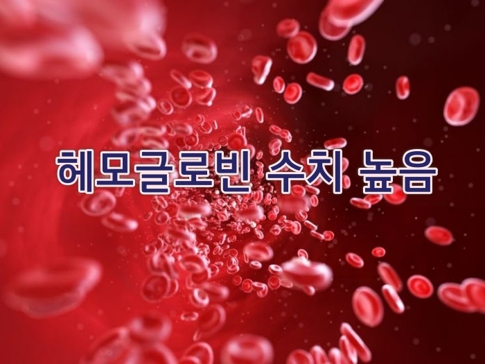 헤모글로빈 수치 높음 낮음 이상증상 알아보기