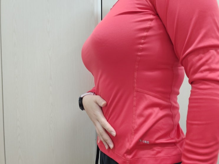  복부지방흡입 바디리프팅 후기 4개월차