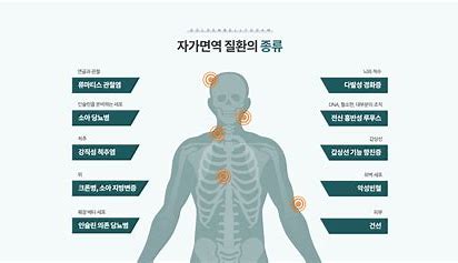 자가면역질환