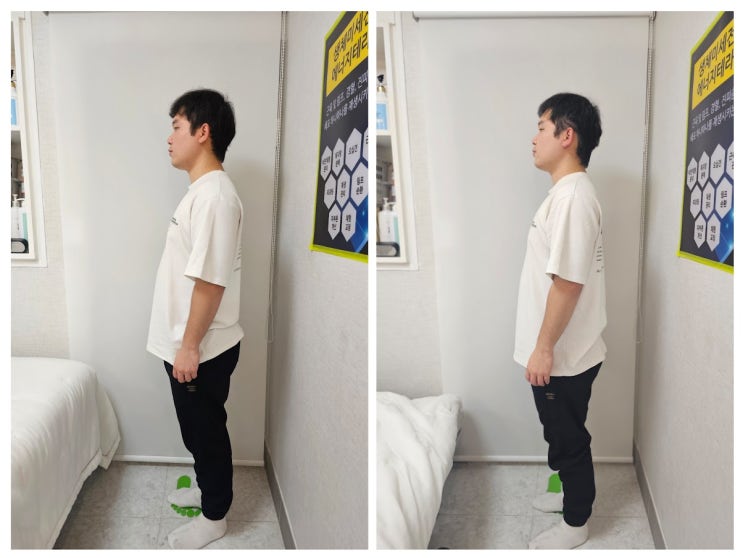  대구 달서구 두골비 안면 비대칭 청아피부체형관리실 윤곽관리 방문 후기