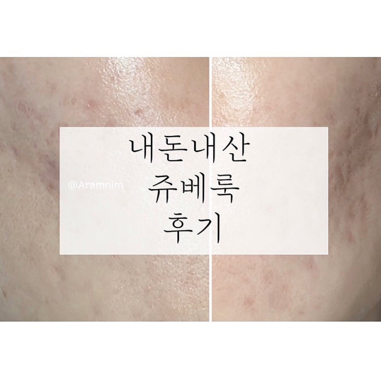 내돈내산 | 쥬베룩 손주사 1년 솔직 후기