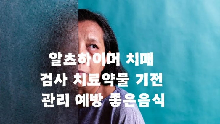  알츠하이머 치매 진단검사 치료약물 기전 관리 좋은음식
