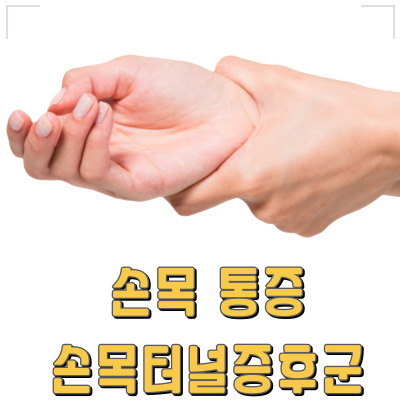 손목 터널 증후군, 내 손목도 위험할까? 증상부터 치료
