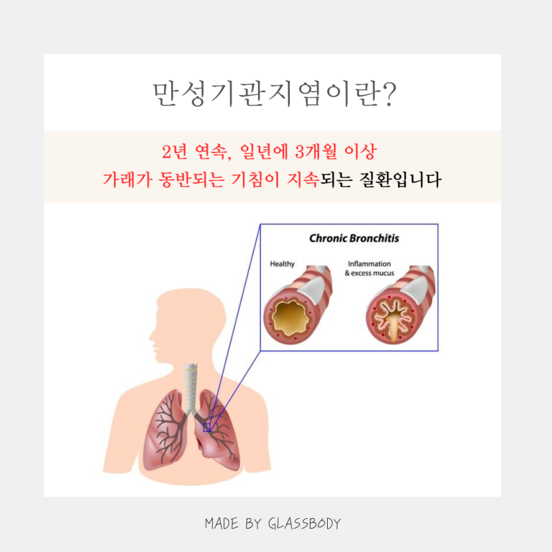 만성기관지염의 증상과 치료방법에 대해 알아보아요