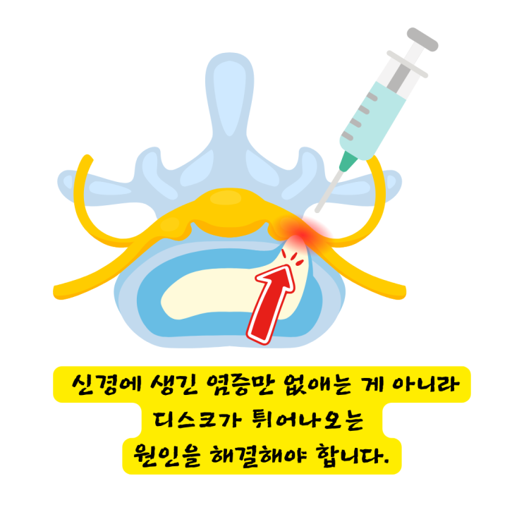  연산동한의원, 허리디스크 수술, 재발 걱정 없이 살고 싶은 분들께.